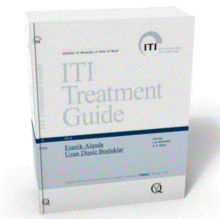 ITI Treatment Guide VOL 6 - Estetik Alanda Uzun Dişsiz Boşluklar