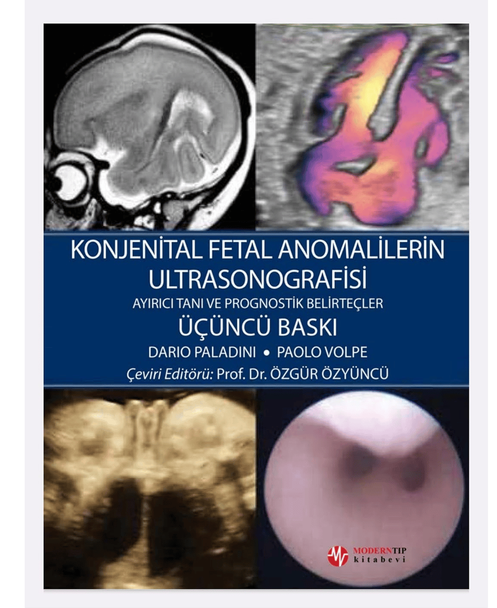 Konjenital Fetal Anomalilerin Ultrasonografisi