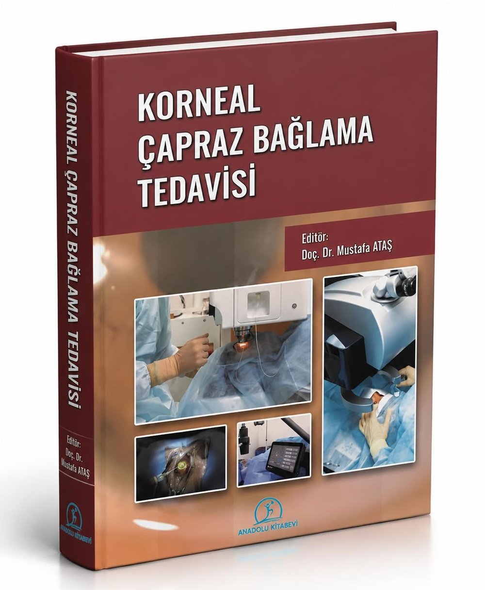 KORNEAL ÇAPRAZ BAĞLAMA TEDAVİSİ