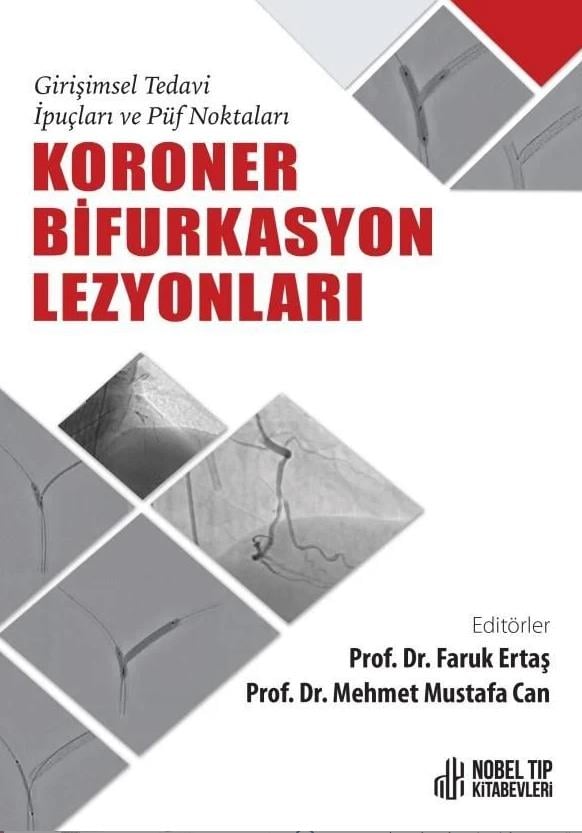 Koroner Bifurkasyon Lezyonları: Girişimsel Tedavi İpuçları ve Püf Noktaları