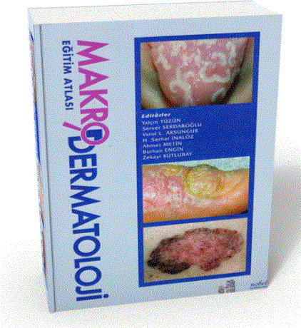 Makro Dermatoloji Eğitim Atlası