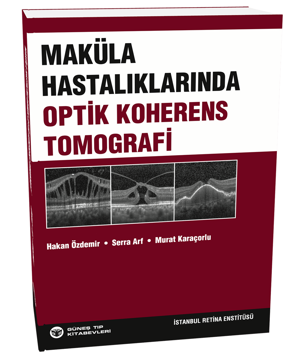 Maküla Hastalıklarında Optik Koherens Tomografi
