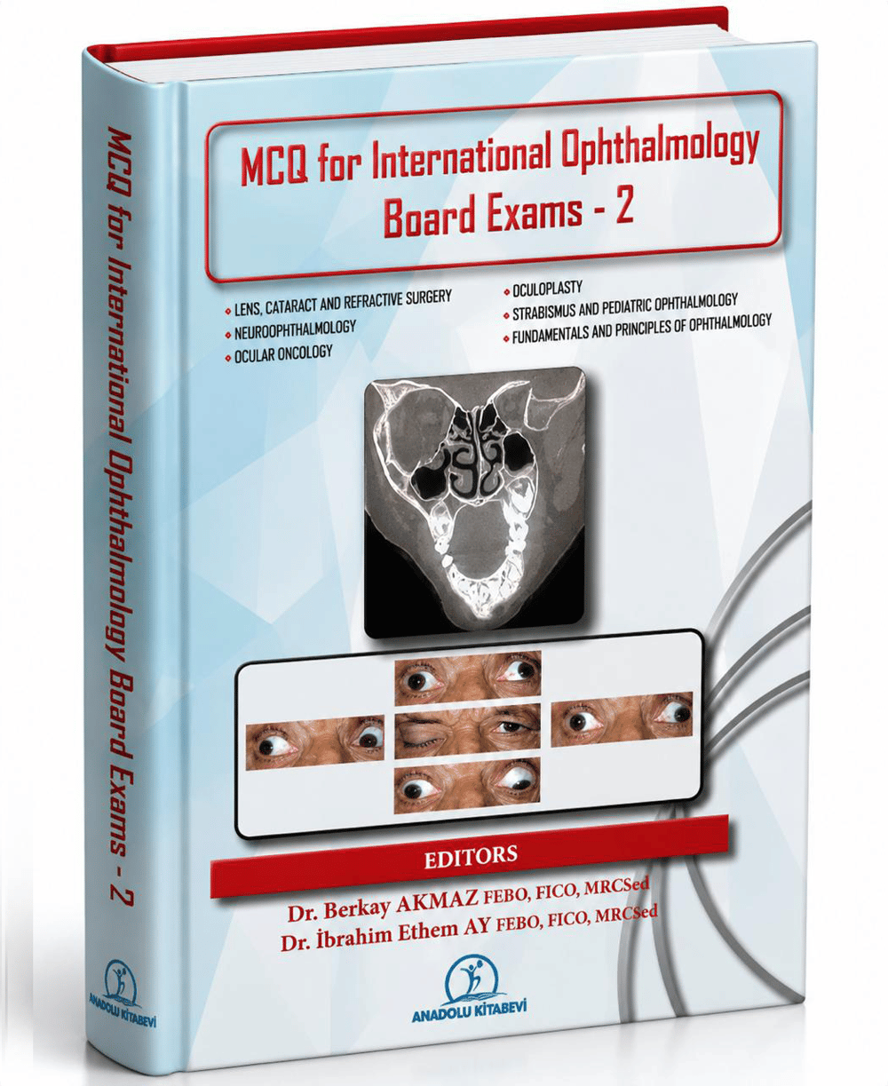 MCQ FOR INTERNATIONAL OPHTHALMOLOGY BOARD EXAMS - 2