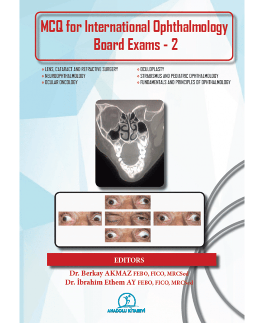 MCQ FOR INTERNATIONAL OPHTHALMOLOGY BOARD EXAMS - 2