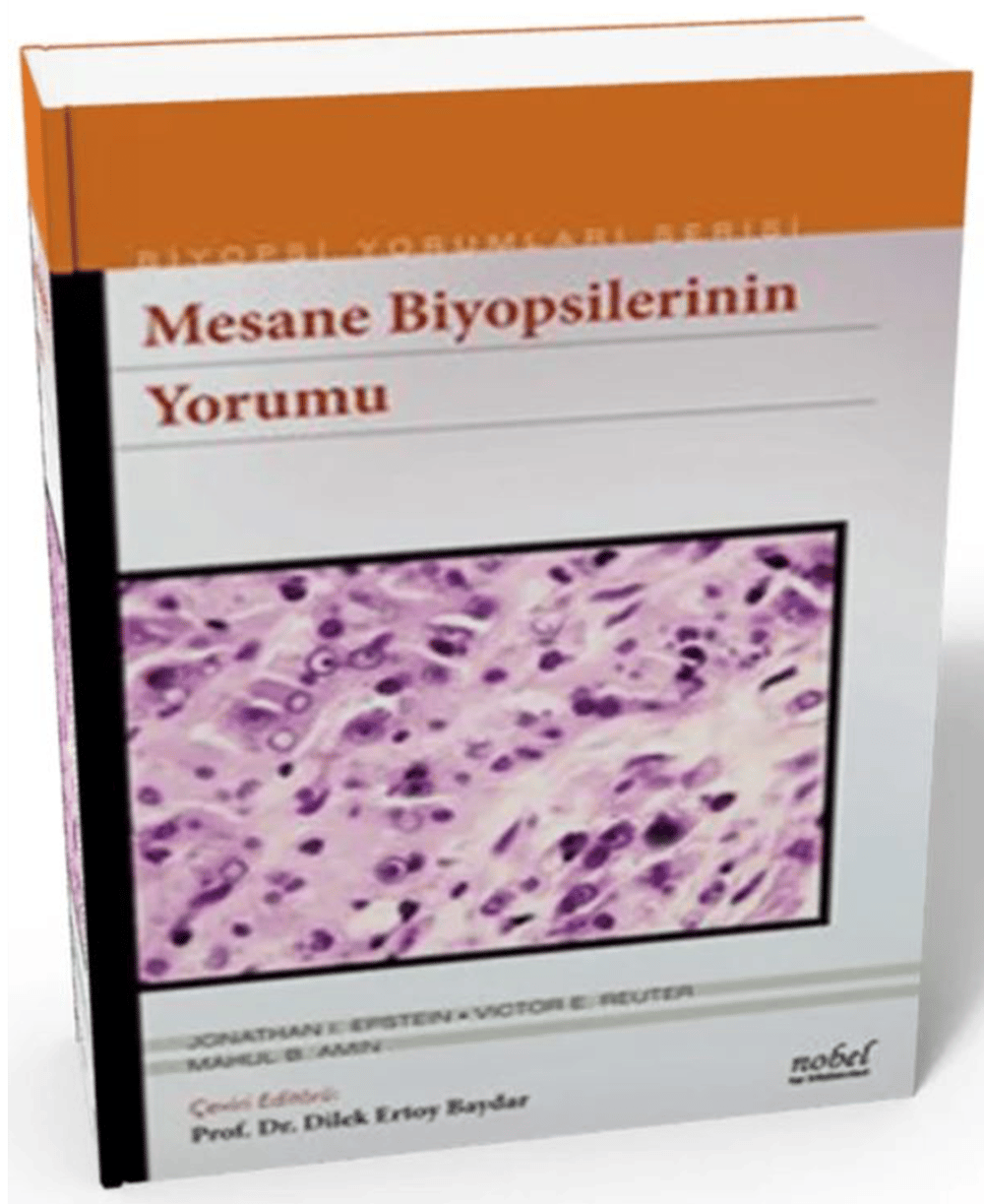 Mesane Biyopsilerinin Yorumu Biyopsi Yorumları Serisi