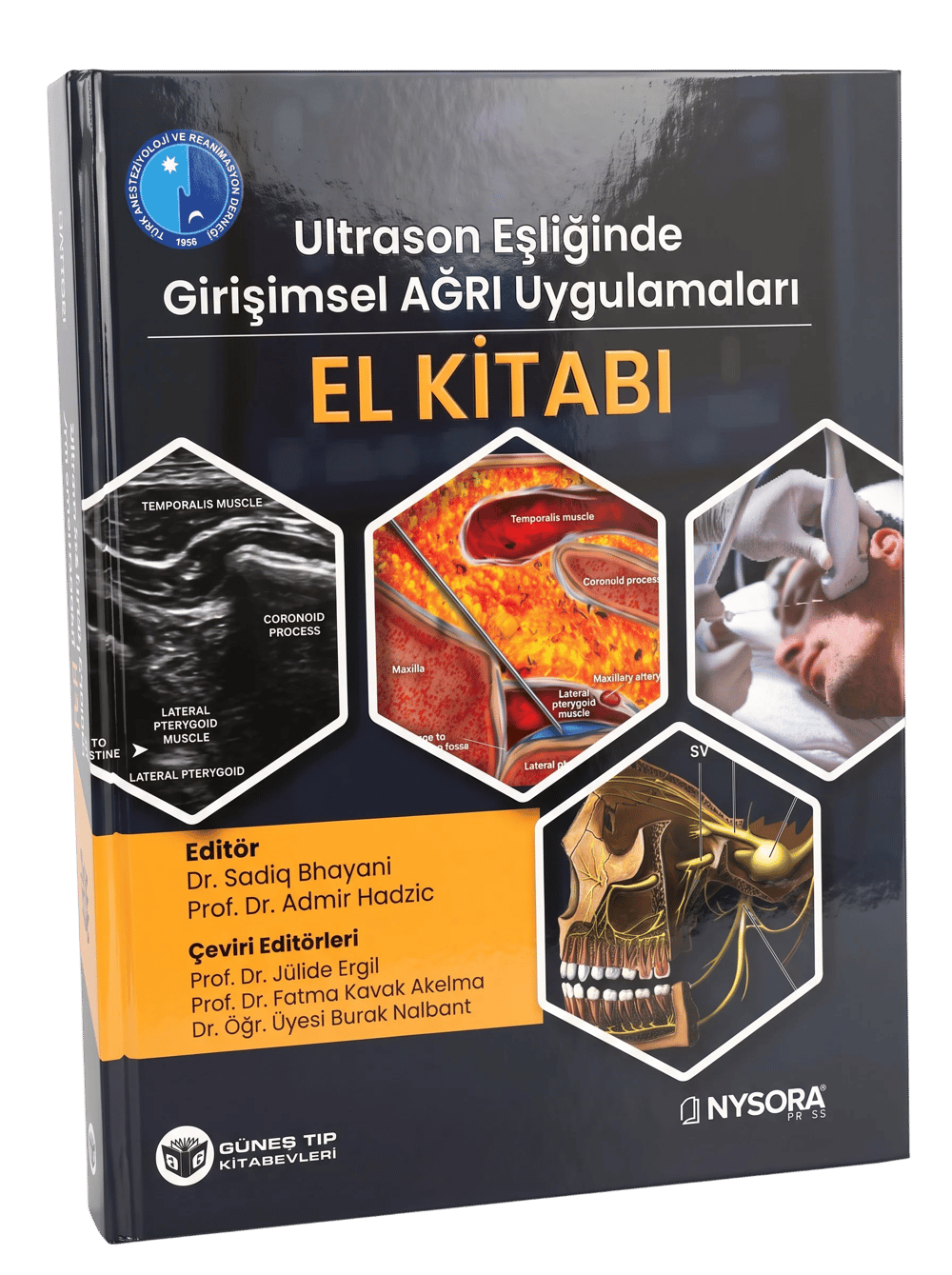 NYSORA - Ultrason Eşliğinde Girişimsel Ağrı Uygulamaları El Kitabı (Video Destekli)