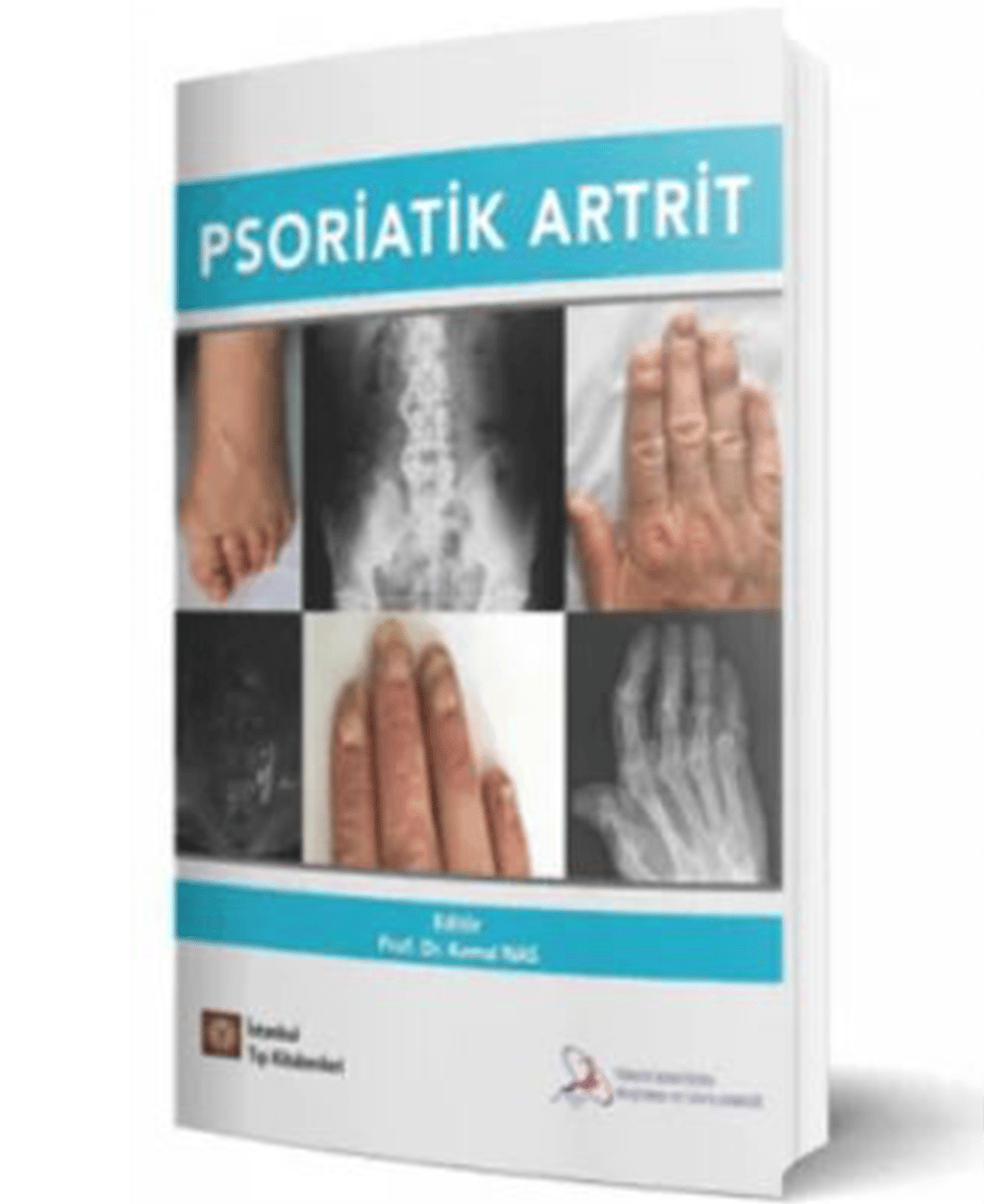 Psoriatik Artrit