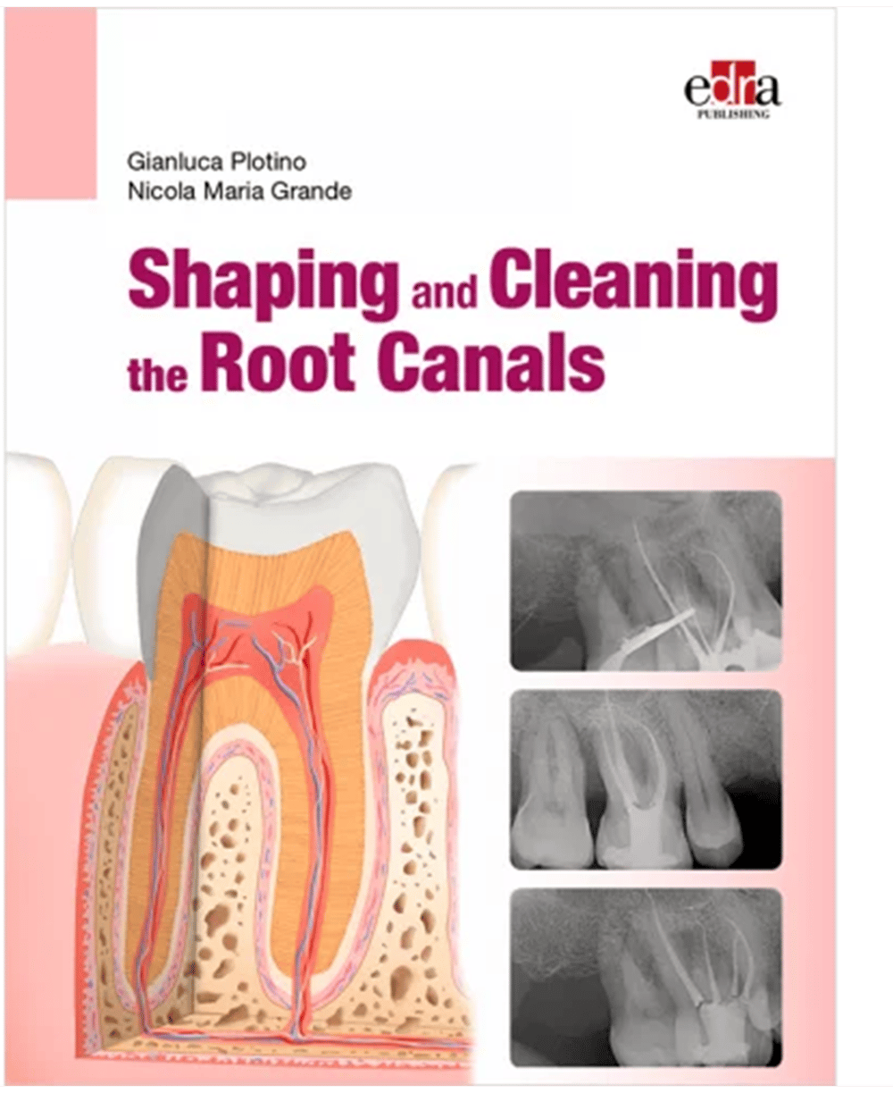 Shaping and Cleaning the Root Canals