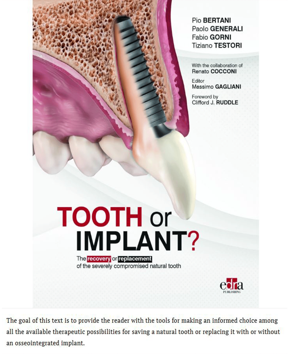 Tooth or Implant