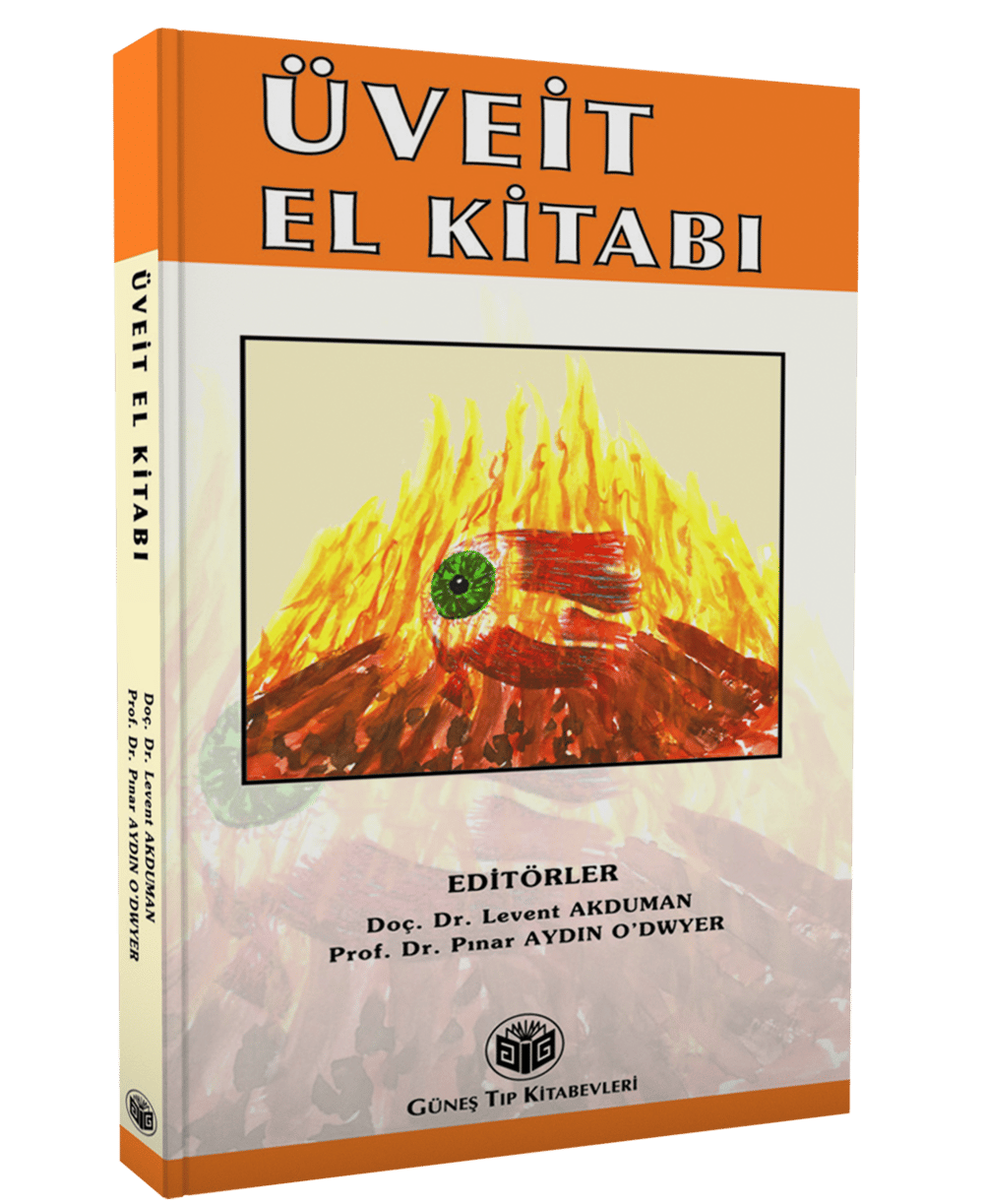 Üveit El Kitabı