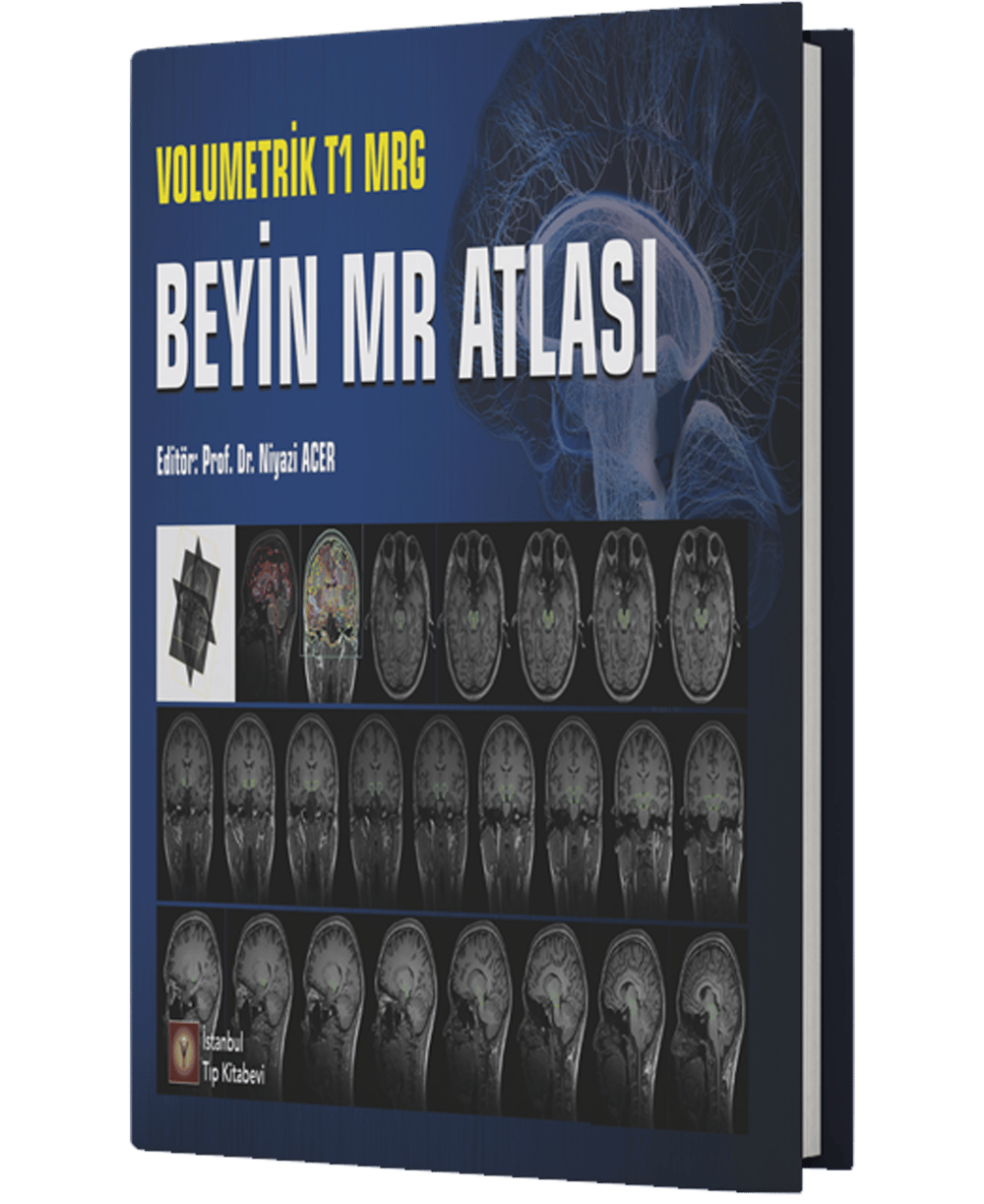 Volumetrik T1 MRG Beyin MR Atlası