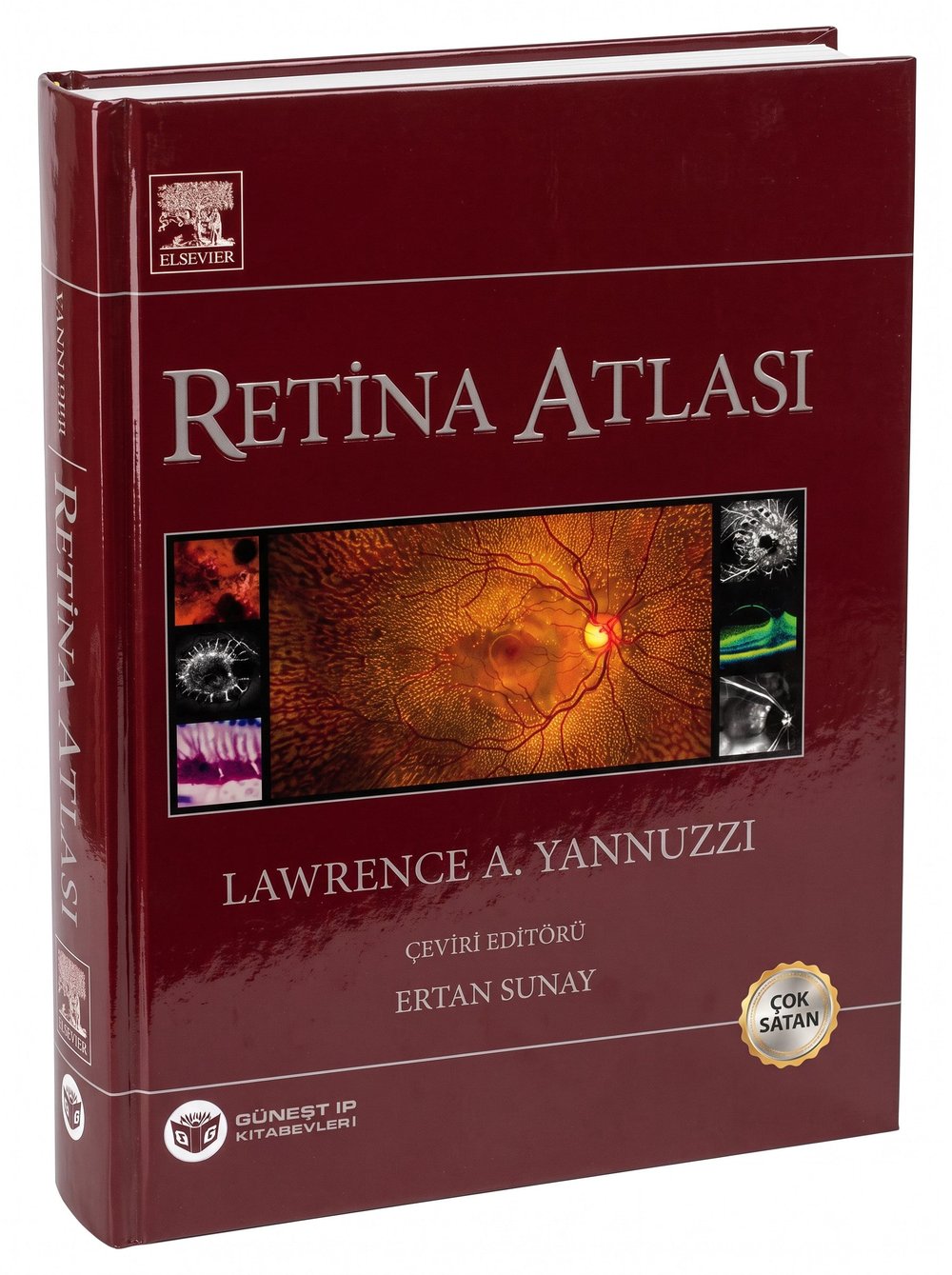 Yannuzzi Retina Atlası