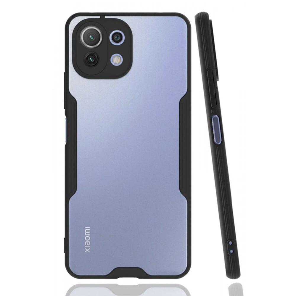 Nettech Xiaomi Mi 11 Lite Uyumlu Platin Seri Arka Koruma Kılıf NT-86524