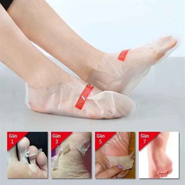 Sunup SN-26965 Ayak Peeling Maskesi (Nasır, Ölü Deri, Egzama Giderici)