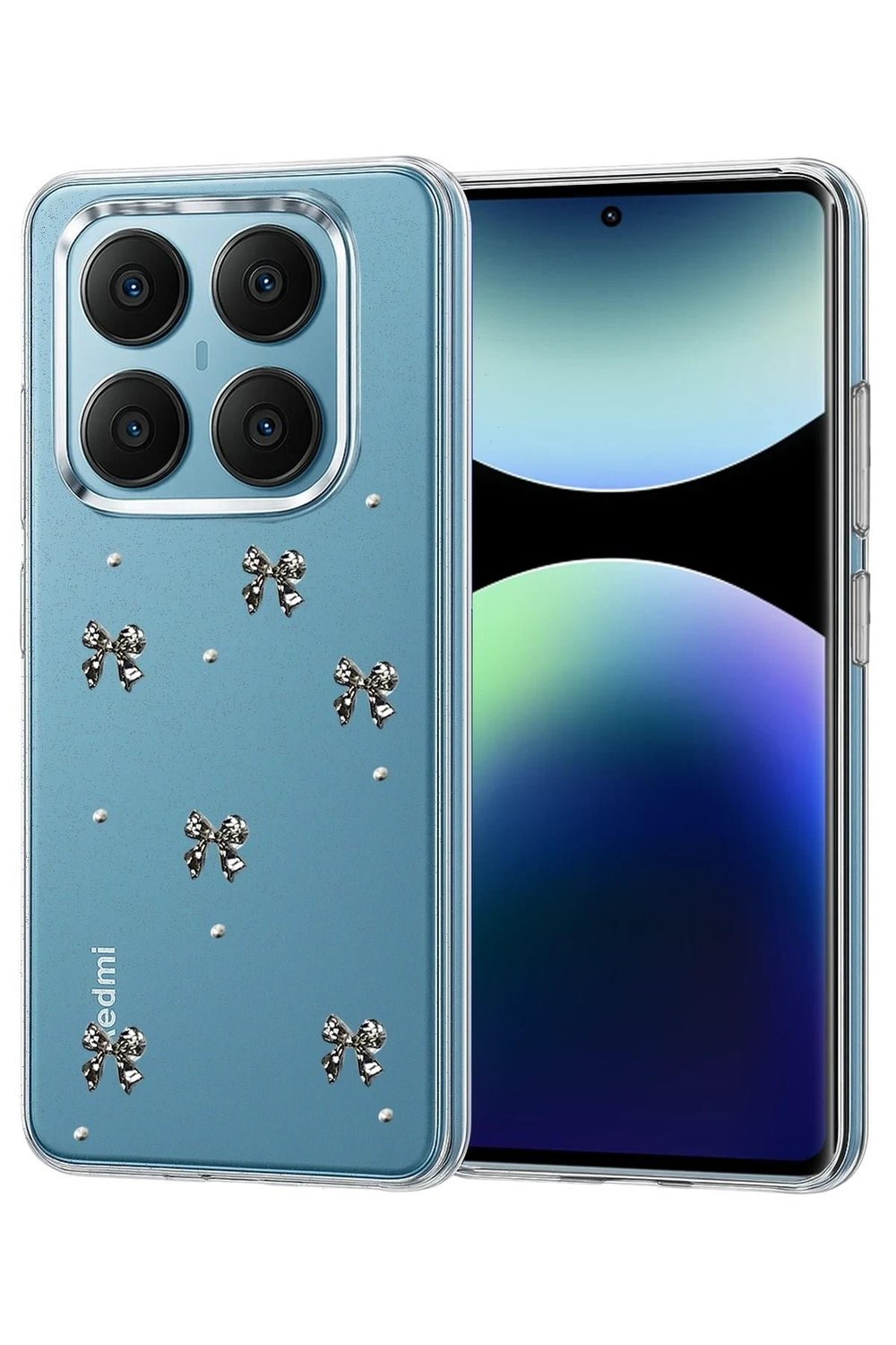 Mey İthalat®   Redmi Note 14 Pro 4G Fiyonk Desenli Kapak - Desen 5