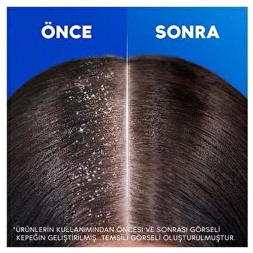 Head&Shoulders Klasik Bakım Şampuanı 800 ml Tüm Saç Tipleri için Kepeğe Karşı Etkili