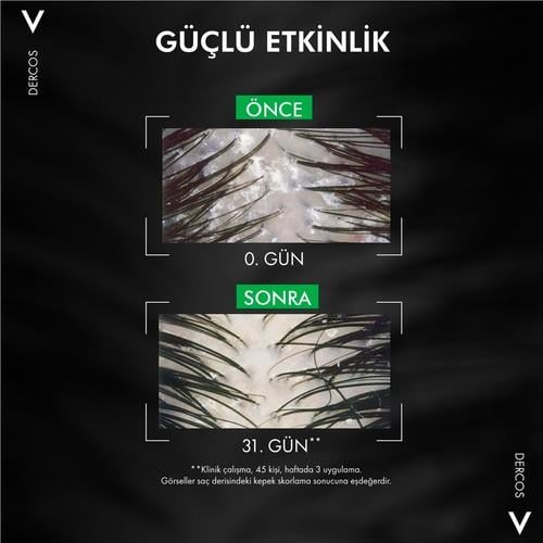 Vichy Dercos Bakım Şampuanı - Kuru Saçlar - Yeniden Dolum Paketi 500 ml