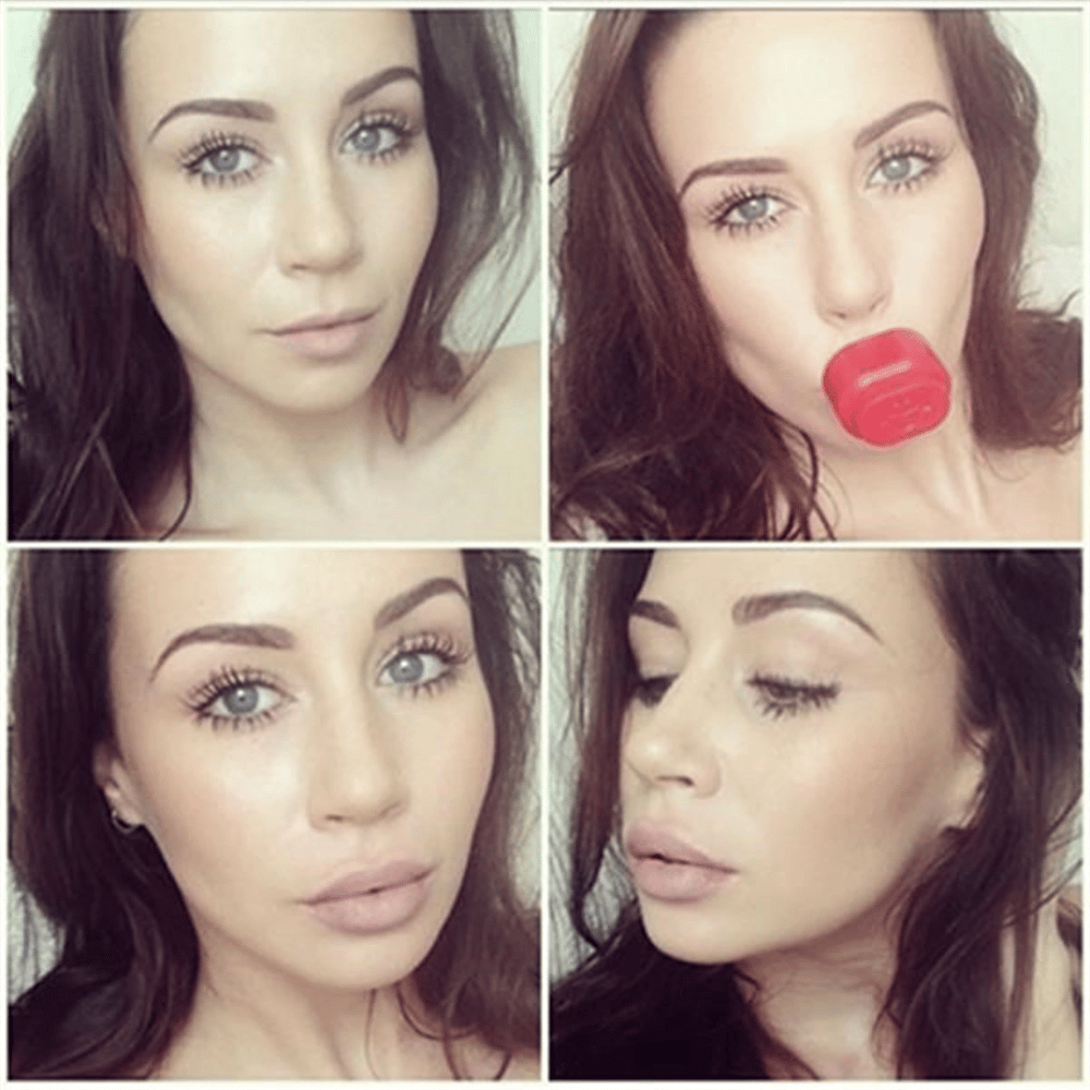 Fullips Doğal Dudak Pratik Dolgunlaştırıcı Aparat (medium) Bx40
