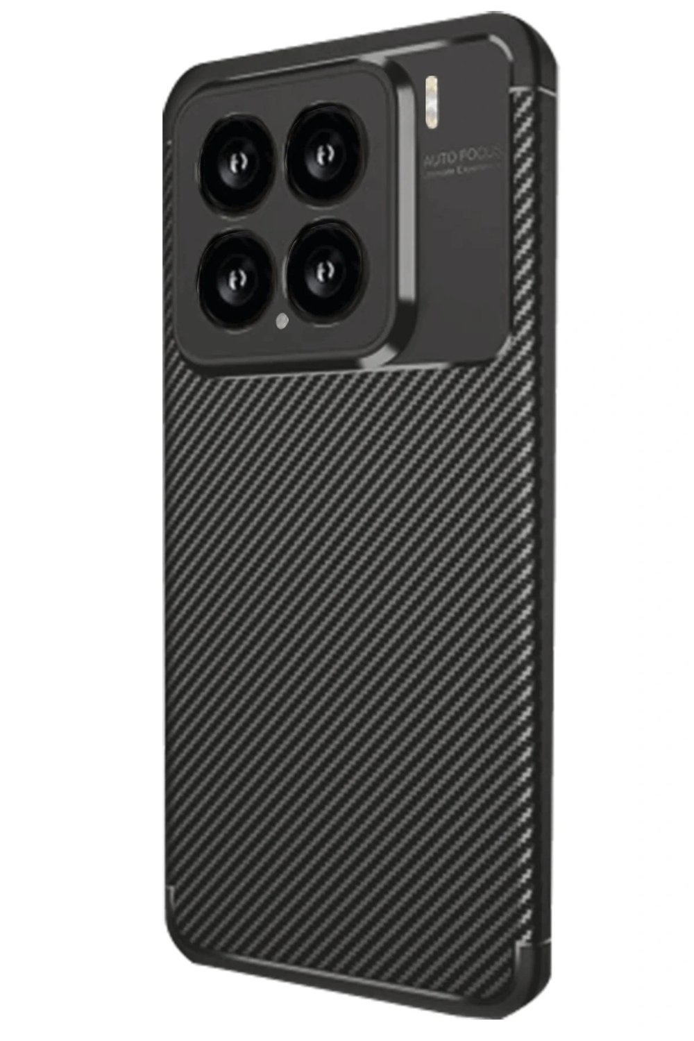 Mey İthalat®   Mi 15 Kılıf Auto Focus Karbon Kapak - Siyah