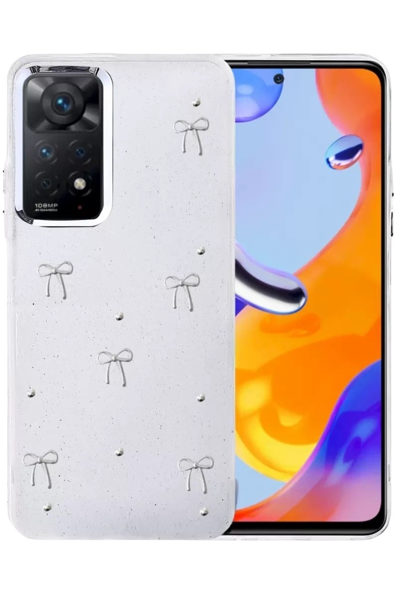 Mey İthalat®   Redmi Note 11 Pro Fiyonk Desenli Kapak - Desen 5