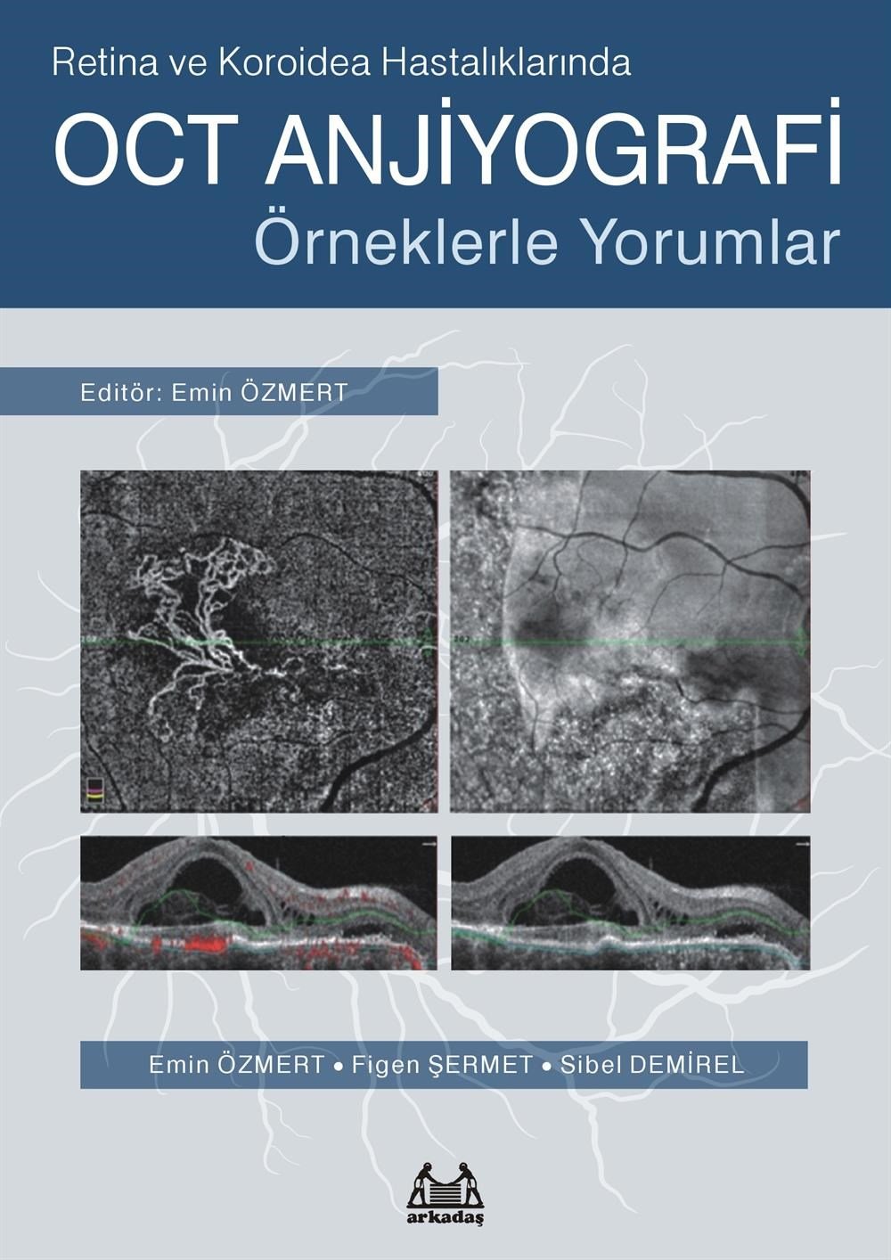 Retina ve Koroidea Hastalıklarında OCT Anjiyografi - Örneklerle Yorumlar