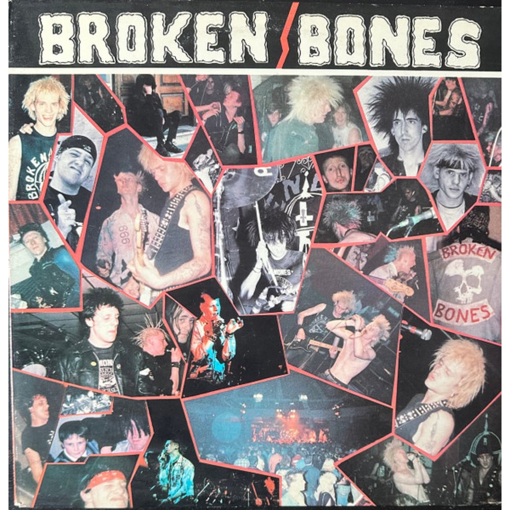 Broken Bones - Never Say Die 12