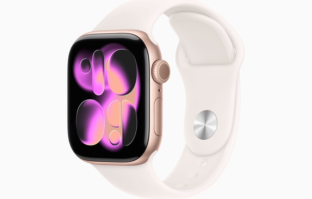 Apple Watch Series 11 Roze Altın Rengi 42 cm Alüminyum Kasa