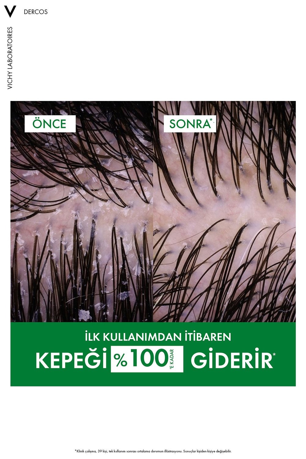 Dercos Anti-Dandruff Şampuan Kepek Karşıtı Normal ve Yağlı Saçlar İçin 200 ml