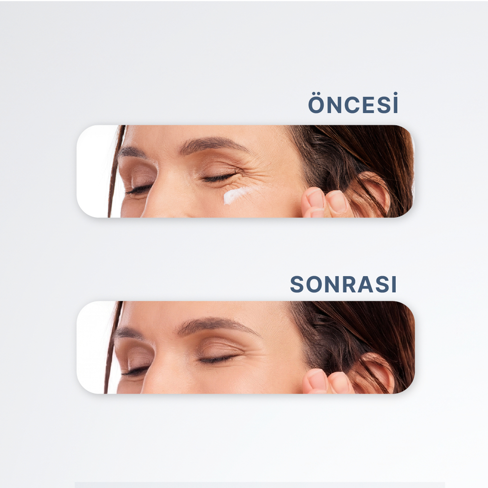 Yoğun Nemlendirici, Kırışıklık ve Koyu Halka Karşıtı Peptit İçeren Göz Çevresi Kremi - 30 ml