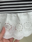 Nurnaz Çizgili Fırfırı Dantelli Tunik-SS13251 Siyah