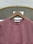 Nurnaz Çizgili Fırfırı Dantelli Tunik-SS13251 Kırmızı