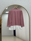 Nurnaz Çizgili Fırfırı Dantelli Tunik-SS13251 Kırmızı