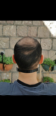 Maske & SiperlikFreshmakerMaske Tutucu Aparat