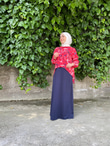 BASKILI GÖMLEKLİ ELBİSE