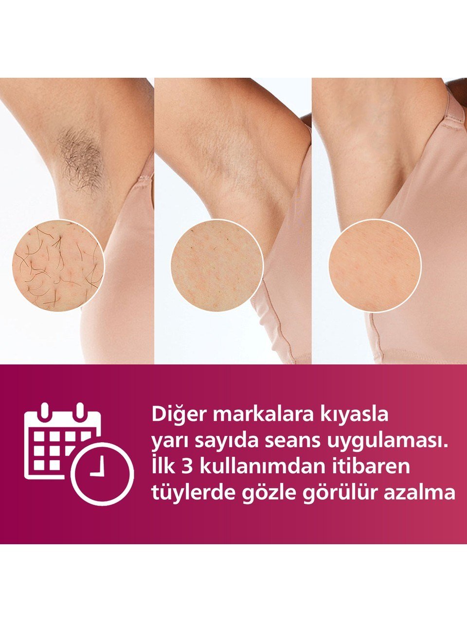 Philips Lumea 8000 Serisi IPL Tüy Alma Cihazı Beyaz Renkli Kablosuz Cilt Temas Sensörü