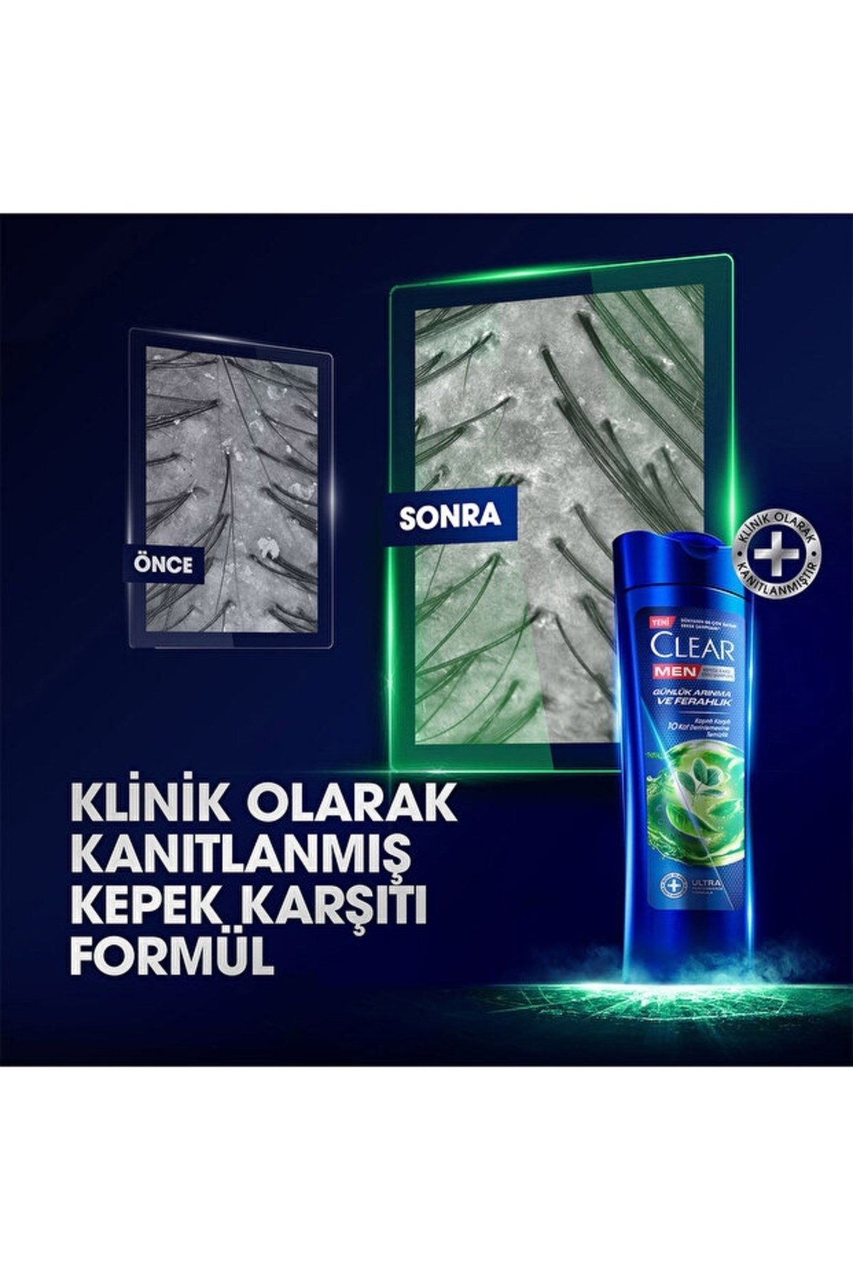Clear Men Kepeğe Karşı Etkili Şampuan Günlük Arınma ve Ferahlık 350 ml X3