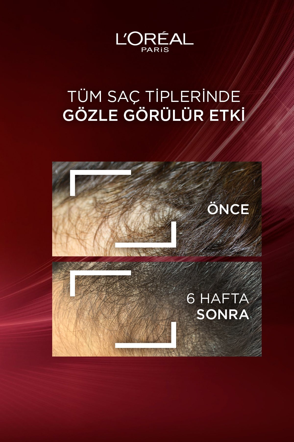 elseve-komple-direnc-dokulme-karsiti-s-d63e-7.jpg