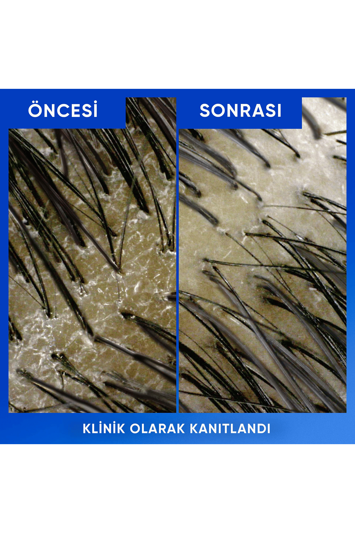 H&S  Arındırma ve Parlaklık Elma Şampuan 800 ml