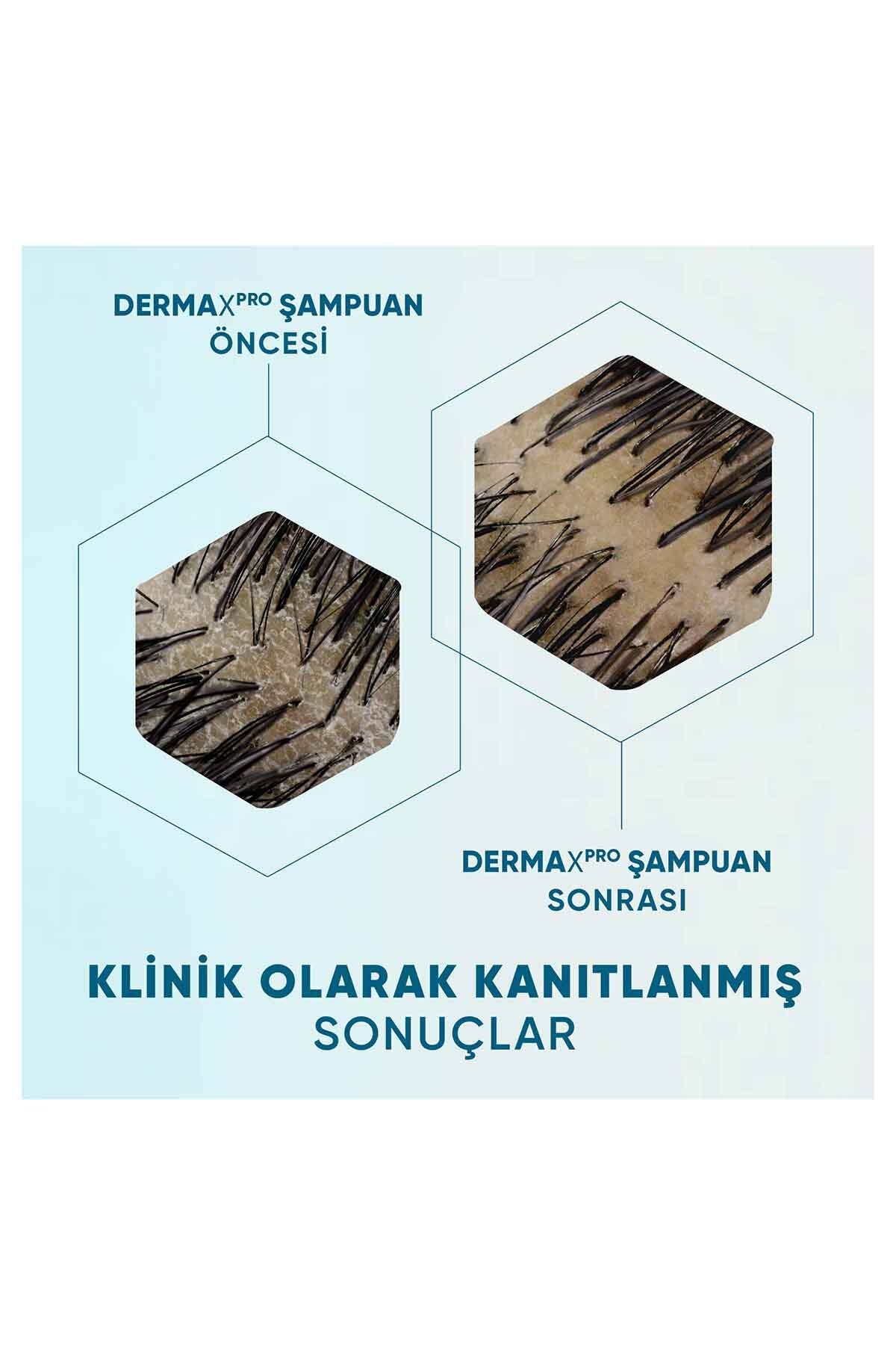 H&S Dermaxpro Nemlendirici Şampuan  300 ml