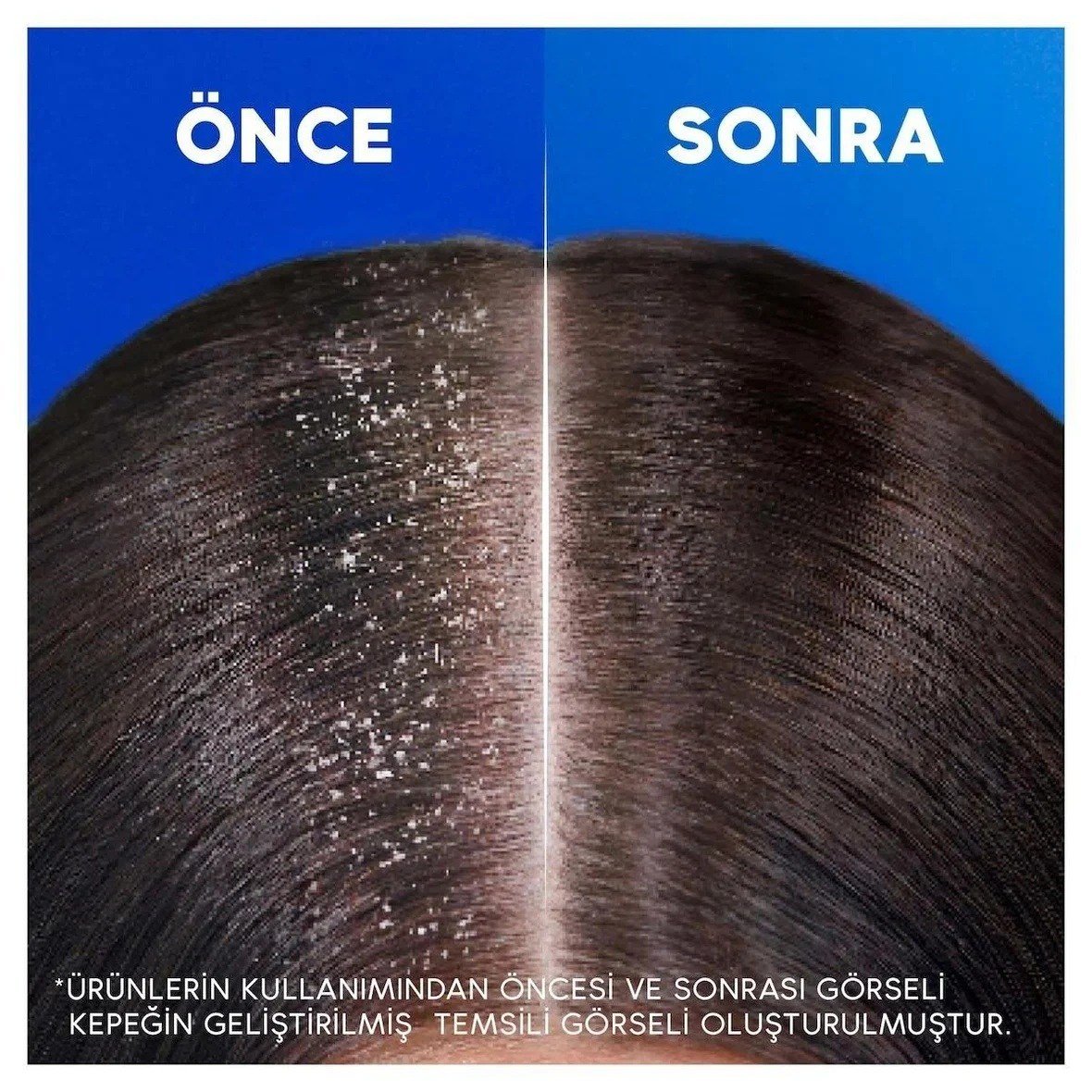 Head & Shoulders Limon Ferahlığı Kepeğe Karşı Şampuan 1'i 1 Arada 330 ml