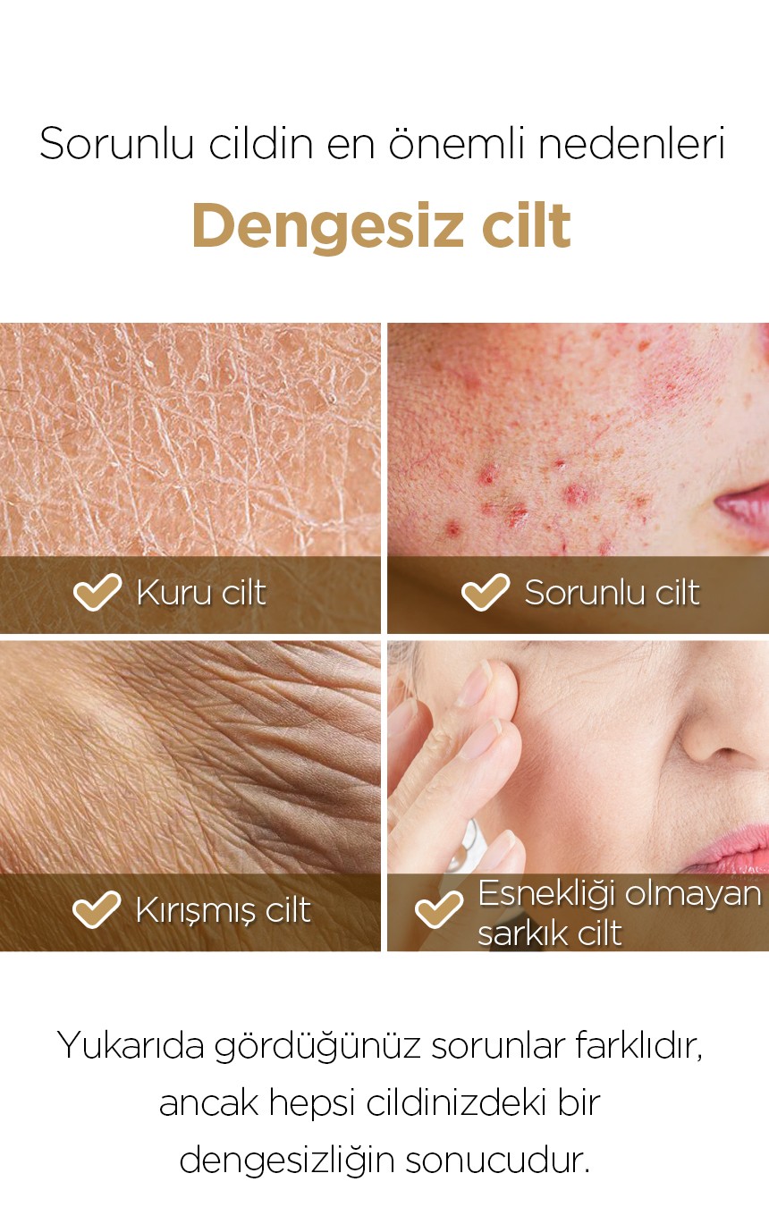 Cilt dengesinin bozulmasını anlatan destek görseli