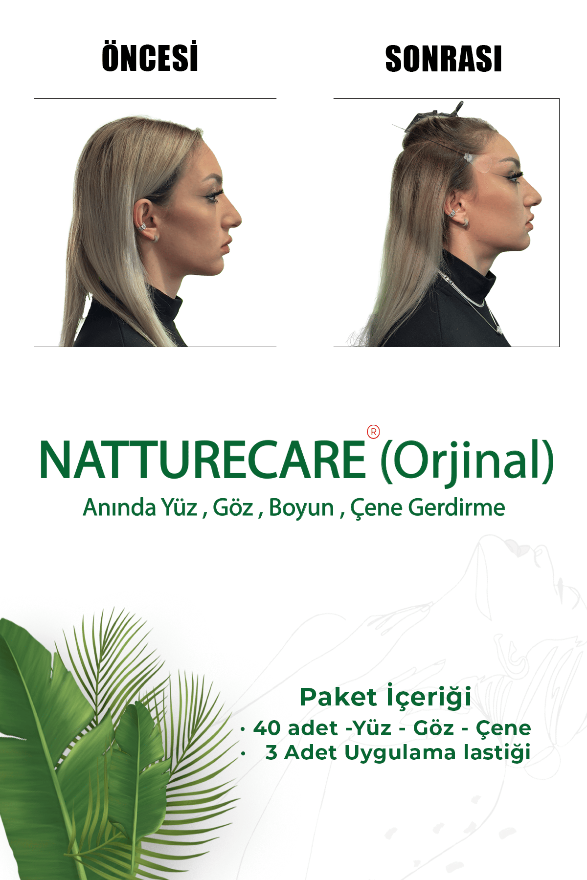 kaş germe bandı
