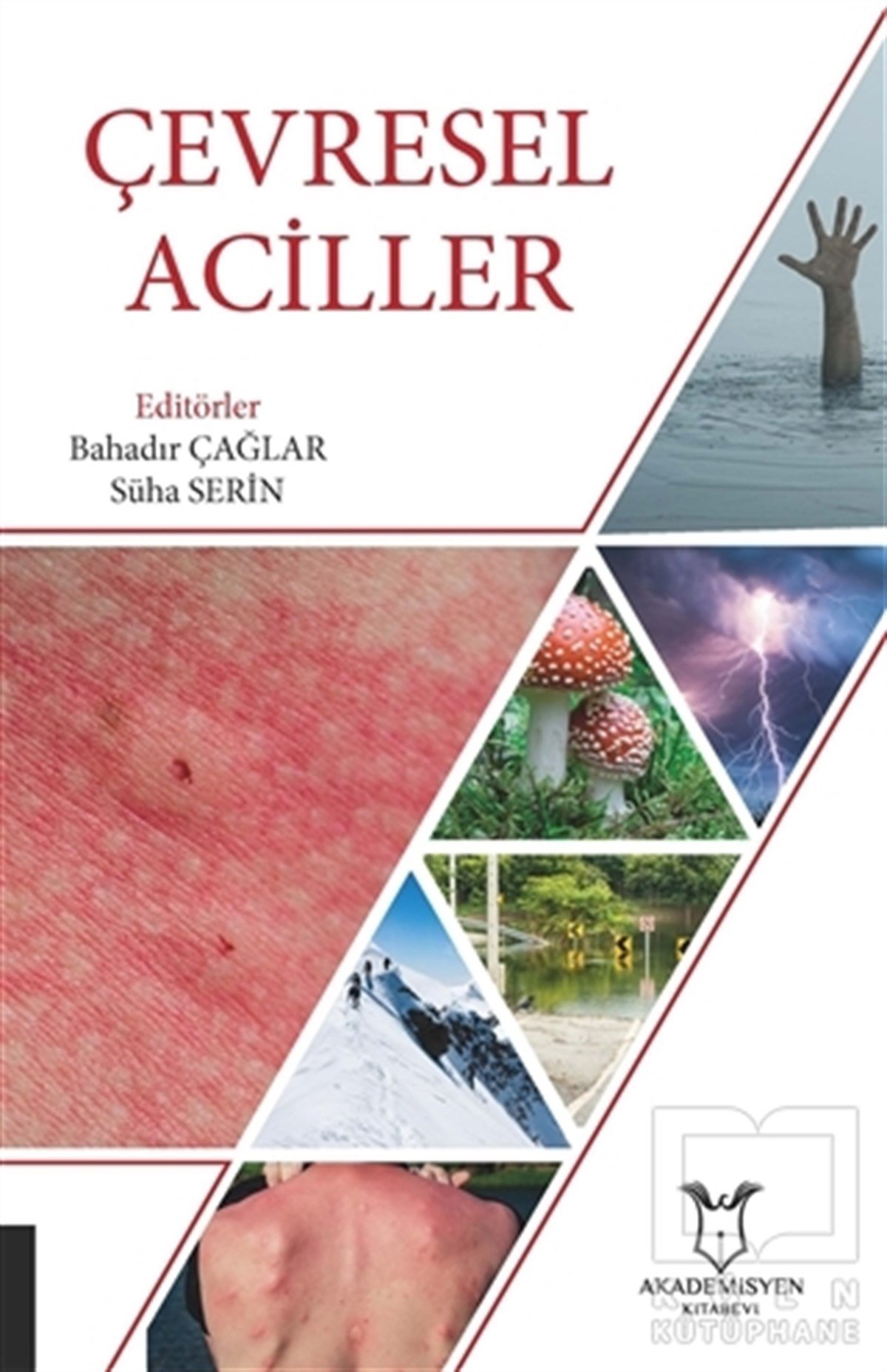 Bahadır ÇağlarAkademikÇevresel Aciller