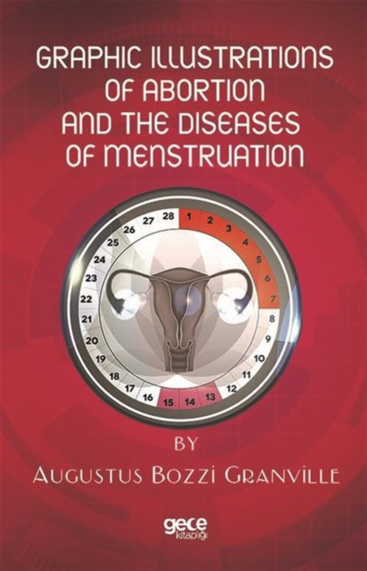 Augustus Bozzi GranvilleArchitecture/Decoration/DesignGraphic Illustrations of Abortion and the Diseases of Menstruation