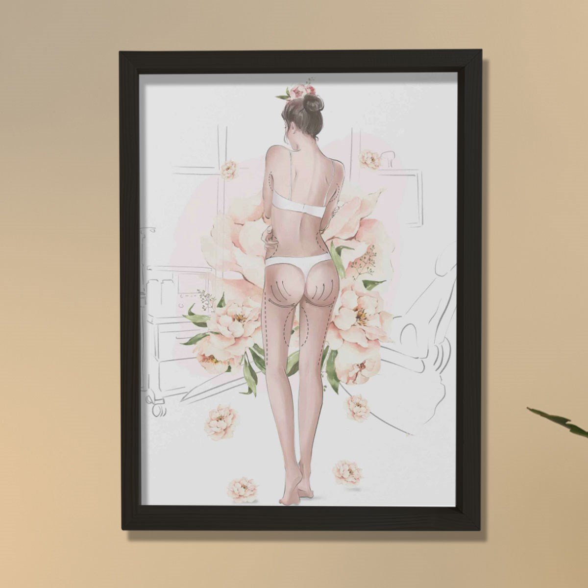 Plastik Cerrah Ameliyat İşaretleri,  Plastik ve Estetik Cerrahı, Doktor Odası Duvar Tablosu