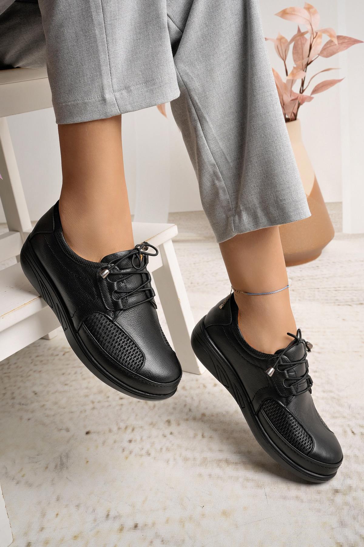 Castle Black 42632 Siyah Hakiki Deri Parmak Çıkıntılı Kadın Ayakkabı