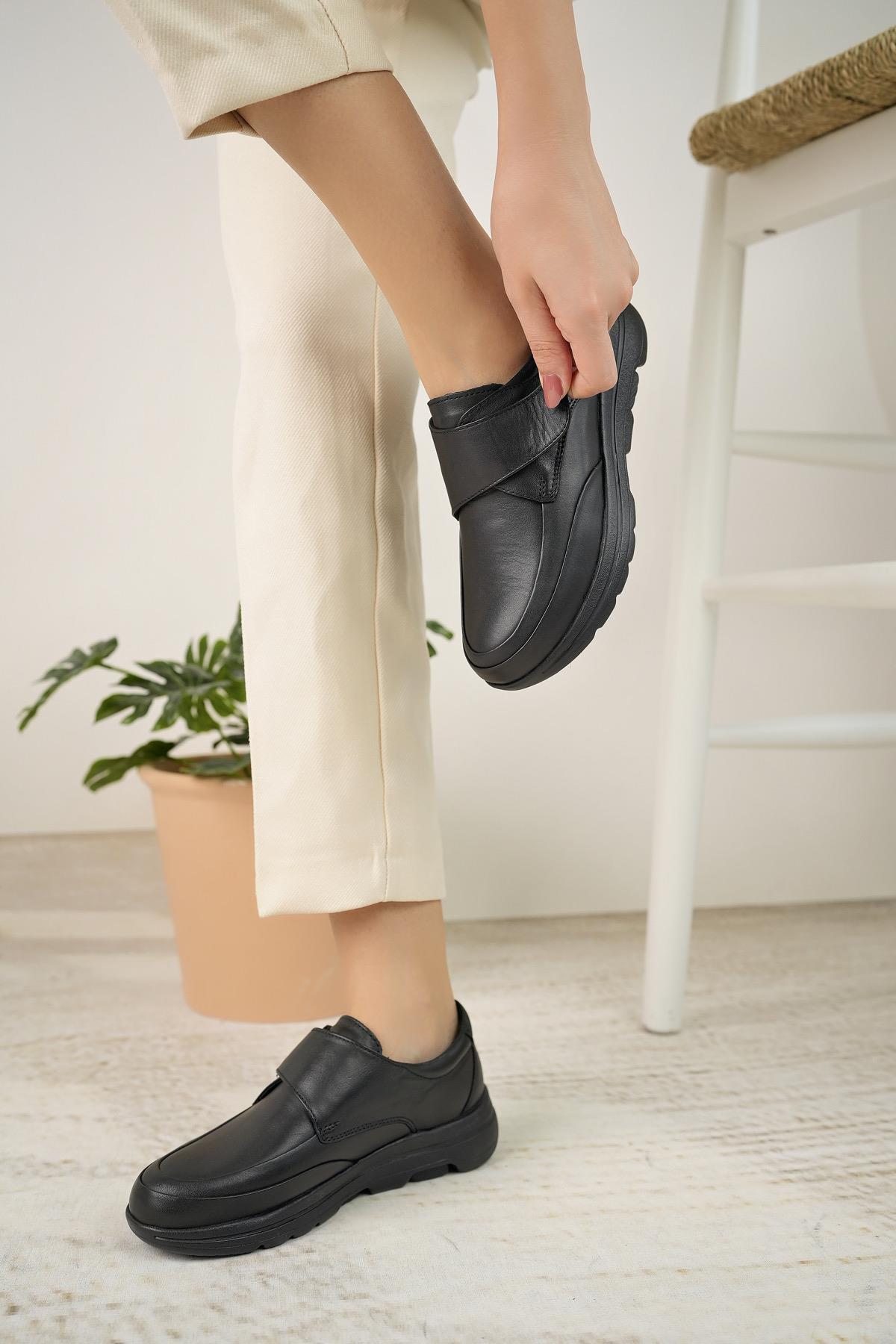 Forex 1029 Siyah Hakiki Deri Cırtlı Anatomik Kadın Ayakkabı