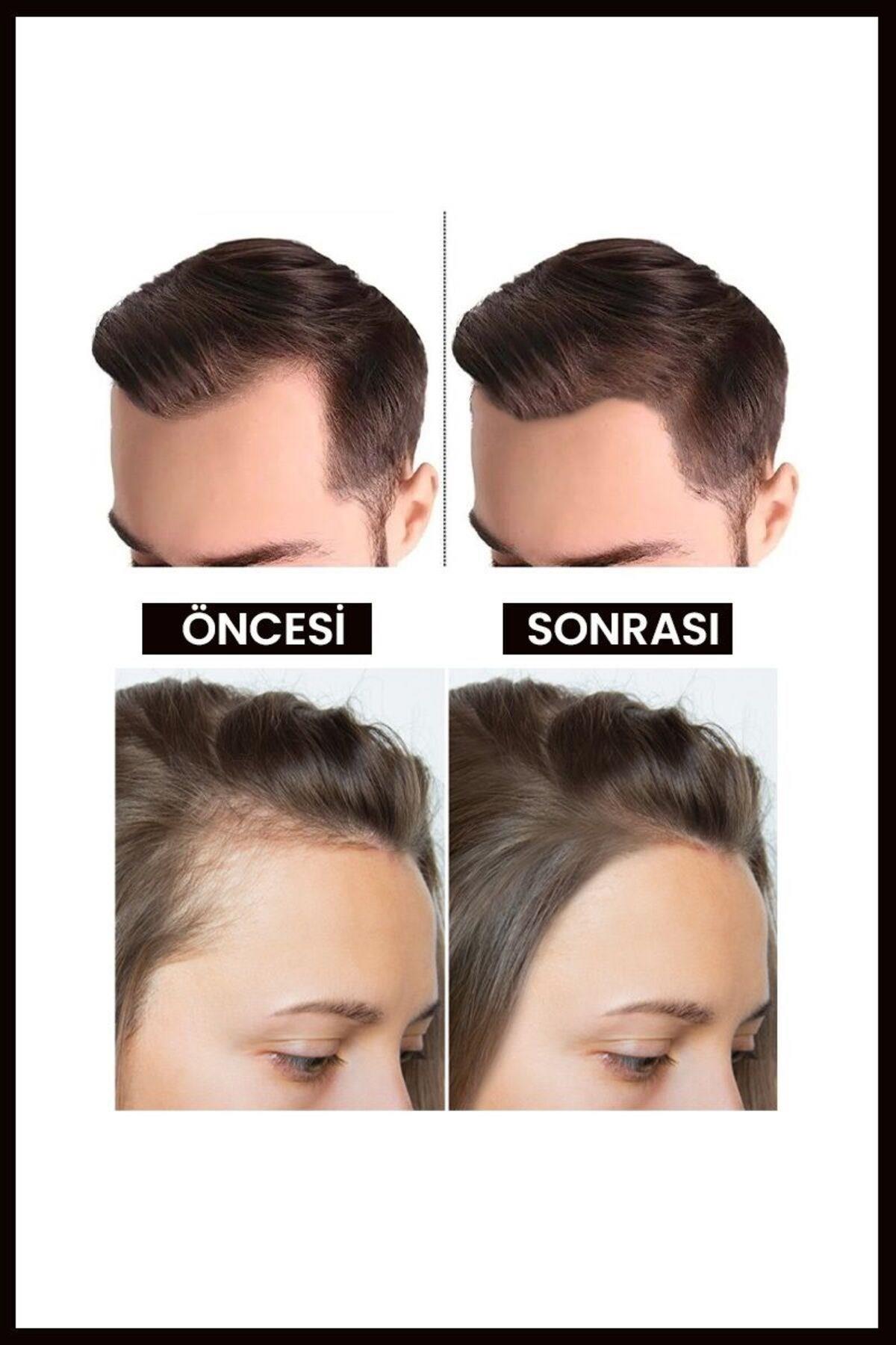 Luis Bien Kara Sarımsak Yağı 50 ml