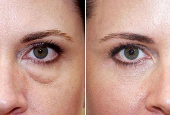 Göz Çevresi Kolajen Serum