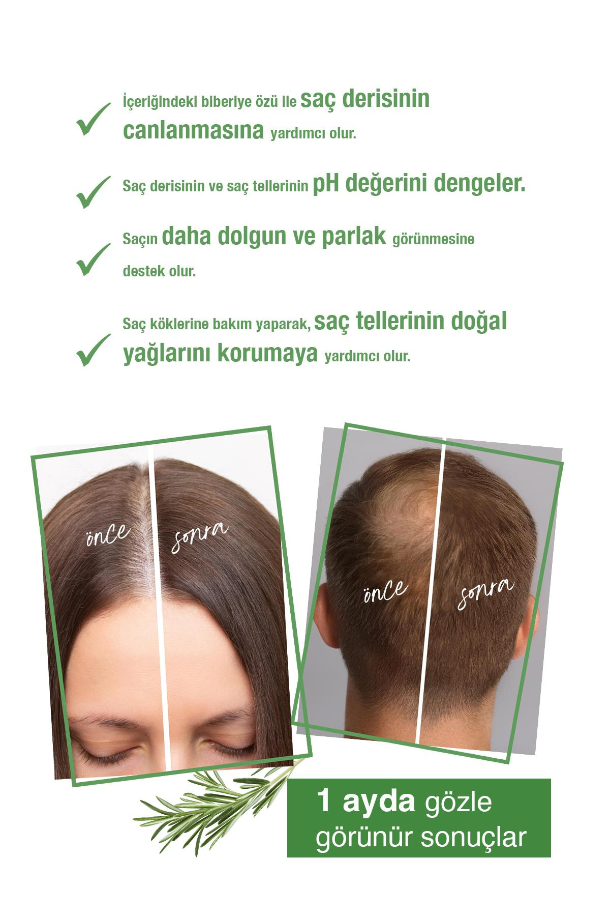 Saç Dökülme Karşıtı,Sağlıklı Hızlı Saç Uzamasına Yardımcı 7 Aktifli Biberiyeli Saç Bakım Suyu 200 ml